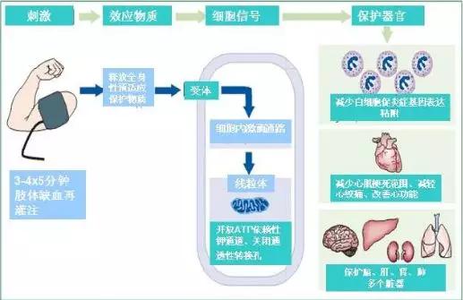 缺血预适应训练仪-心脑血管疾病预防与辅助治疗的新方法