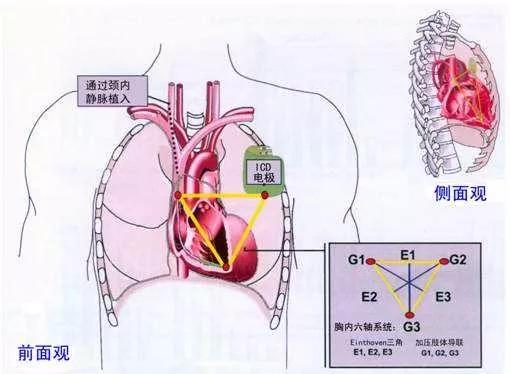 缺血预适应训练仪-心脑血管疾病预防与辅助治疗的新方法
