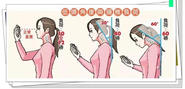 养护:大部分患者都会有颈椎生理曲度变直或者反弓,这都是低头惹的祸.