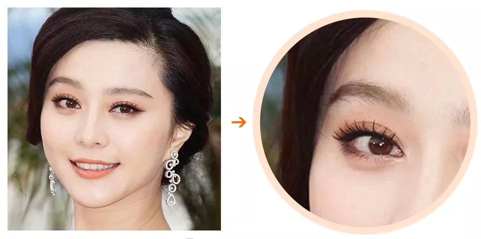 左眉平顺低垂,与额骨眶面边缘几乎持平,眉眼间距偏窄,看起来不够精神