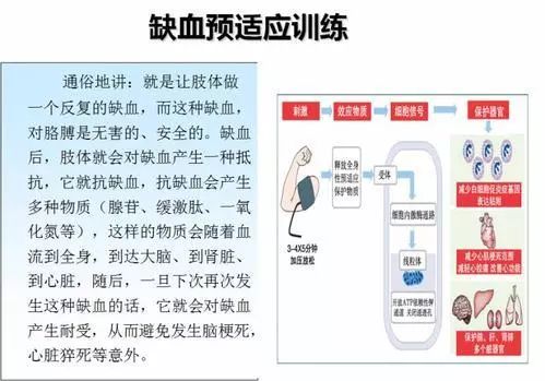预防和治疗心脑血管疾病新技术-缺血预适应