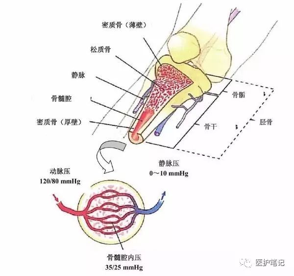 涨知识还可以这样输液骨髓腔输液技术