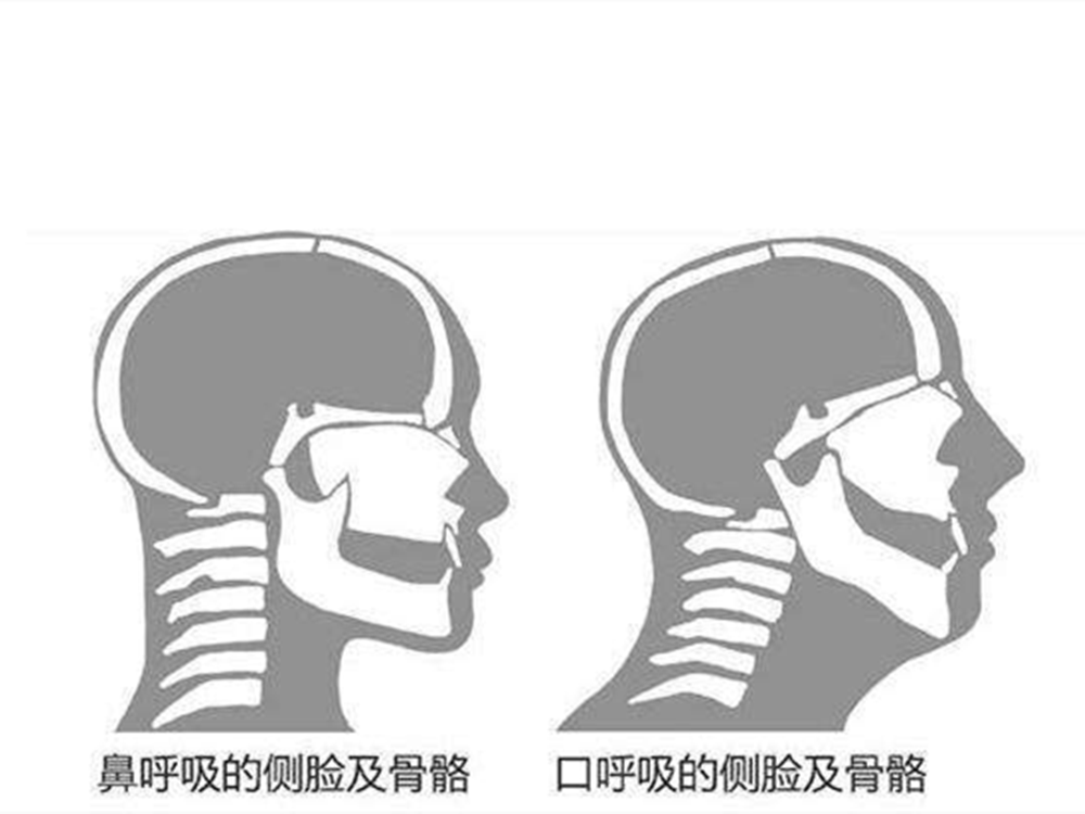                     原创            乳牙不齐没关系？牙科医生建议：遇到这种情况要及时矫正