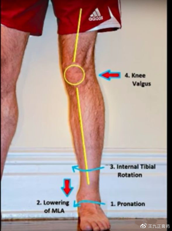 足内倾很容易理解,就是脚踝向外撇,足底向内扣.好