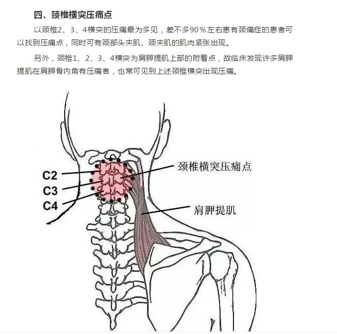 软组织常见压痛点_韧带