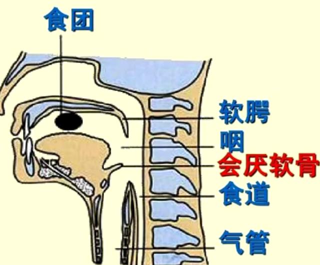 一男子喉咙痛不在意,几天后"哑"了 医生:差点要人命!_会厌