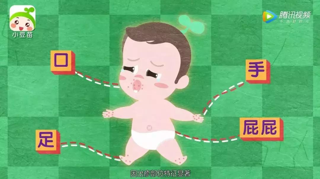                     深圳人注意！5月这种病多一倍，家有孩子一定要小心！