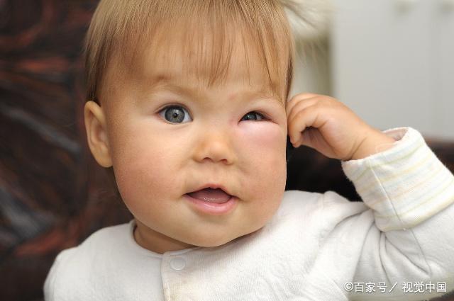                     夏天蚊子喜欢叮咬宝宝和血型无关，爸妈别被“血腥说”交智商税了