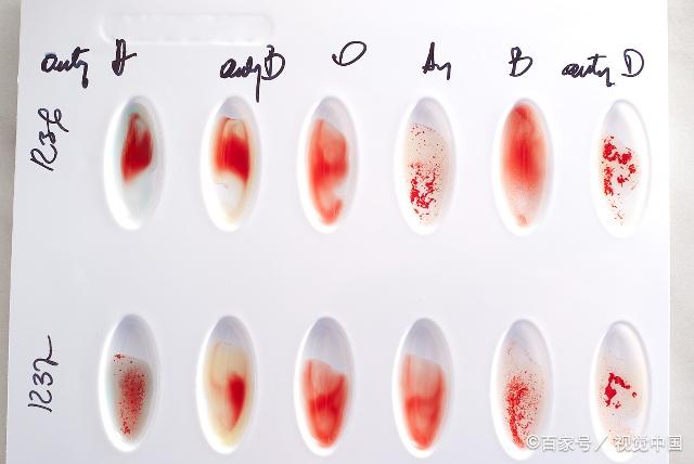                     夏天蚊子喜欢叮咬宝宝和血型无关，爸妈别被“血腥说”交智商税了
