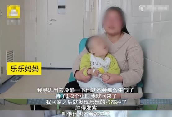                     男婴被亲爸打成脑积水，还不准母亲送他去医院，孩子至今不会说话