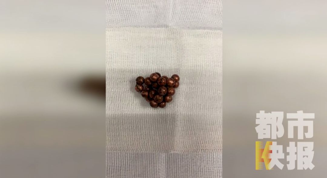                     @所有家长,此物极其危险!13岁男孩竟将它塞进下体憋了三个月,路都走不了