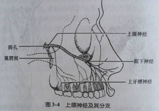 进针点:翼下颌皱襞中点外侧3-4毫米或颊脂垫尖处.针尖退至黏膜下.