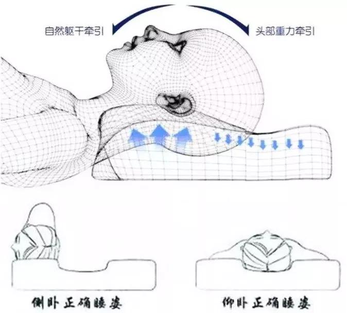 颈椎病正确的睡觉姿势——仰睡图侧睡时,头部较肩部微微向后,双髋及