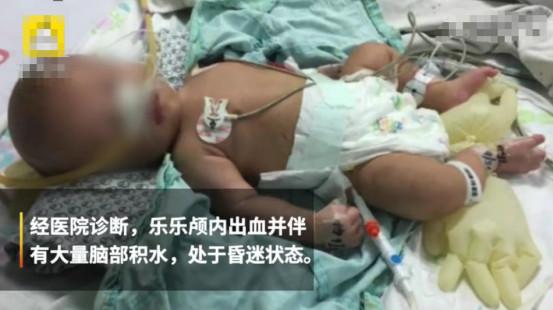                     男婴被亲爸打成脑积水，还不准母亲送他去医院，孩子至今不会说话