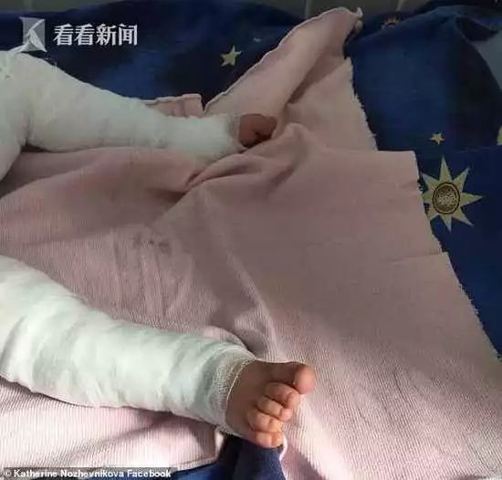                     已有多名宝宝受伤，夏天，千万别这样给宝宝洗澡，否则就是在害他