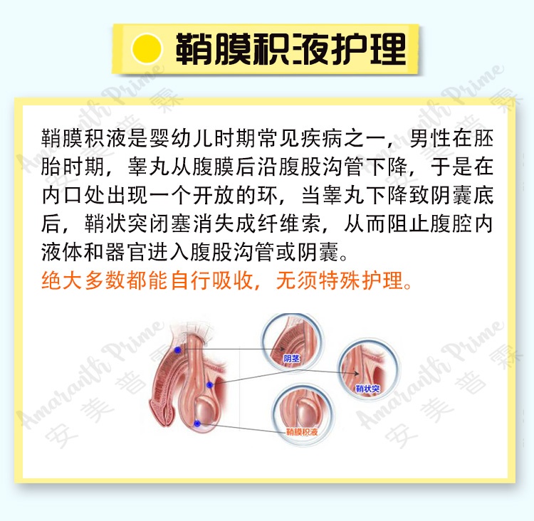 五, 鞘膜积液护理如果宝宝阴囊持续增大,局部压力增高,宝宝哭闹不止