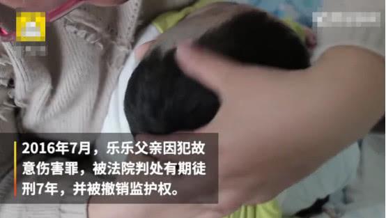                     男婴被亲爸打成脑积水，还不准母亲送他去医院，孩子至今不会说话