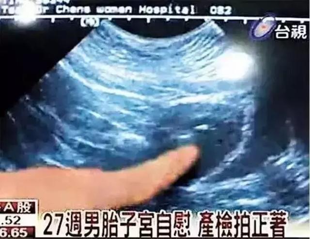                     原创            孩子夹腿、摸私处就要立马制止？被性早熟坑坏的孩子还少吗！