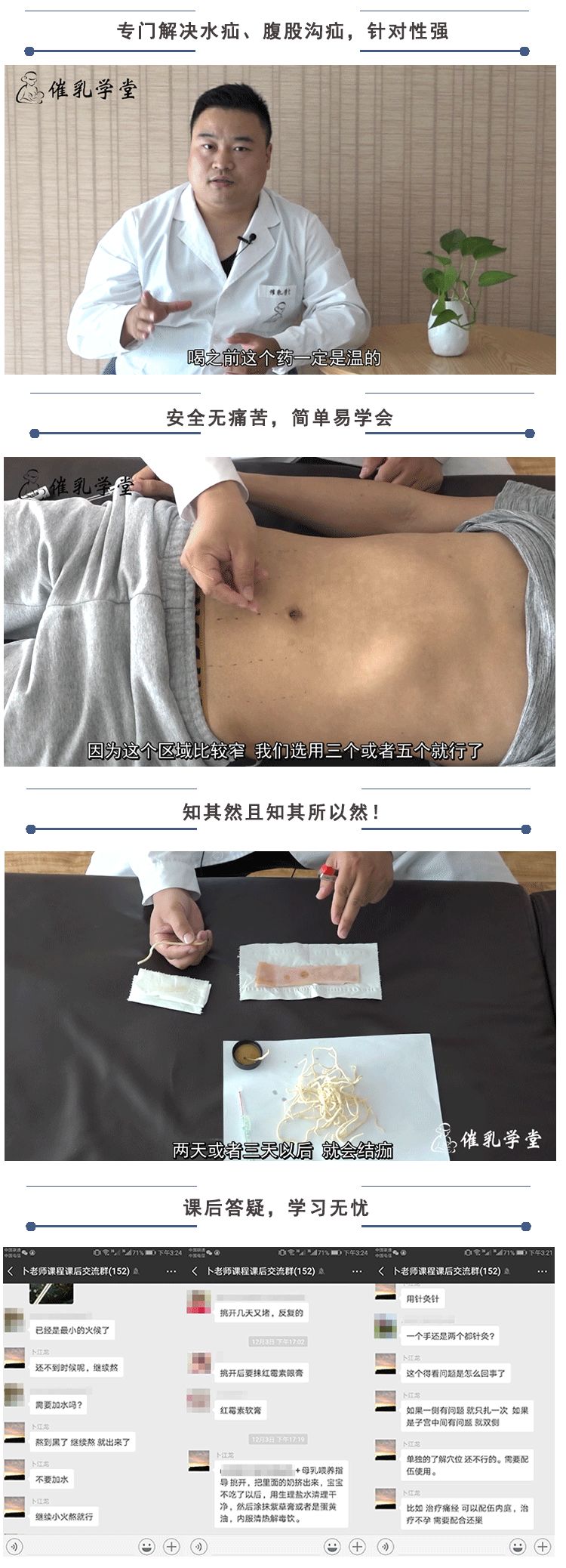                     这套珍藏的鞘膜积液（水疝）的解决方法，让宝宝远离全麻手术！