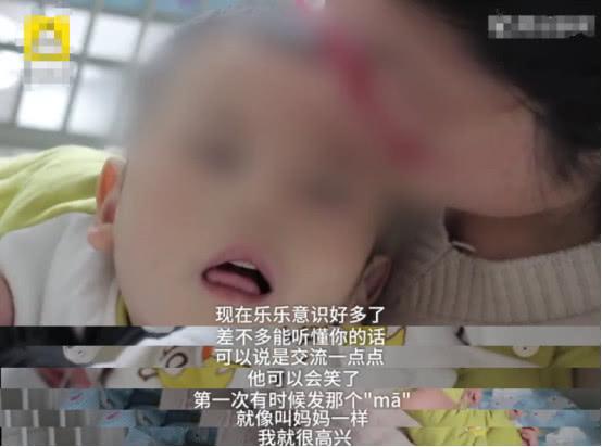                     男婴被亲爸打成脑积水，还不准母亲送他去医院，孩子至今不会说话