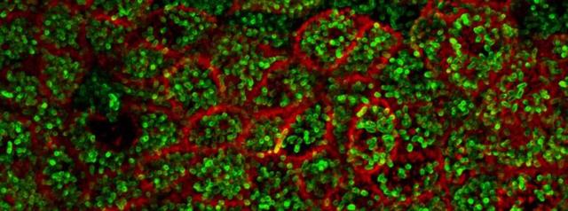 科学重磅细胞膜上一双小手竟成为细菌在抗生素治疗中耐药的原因