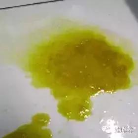                     怀疑孩子拉肚子了怎么办？