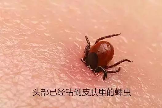 警惕!宝宝身上突然出现这样的小黑点,原来不是虫子叮咬