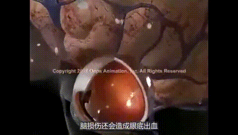                     这个致命的哄娃睡觉动作，90%的人都做过，严重者导致脑出血！