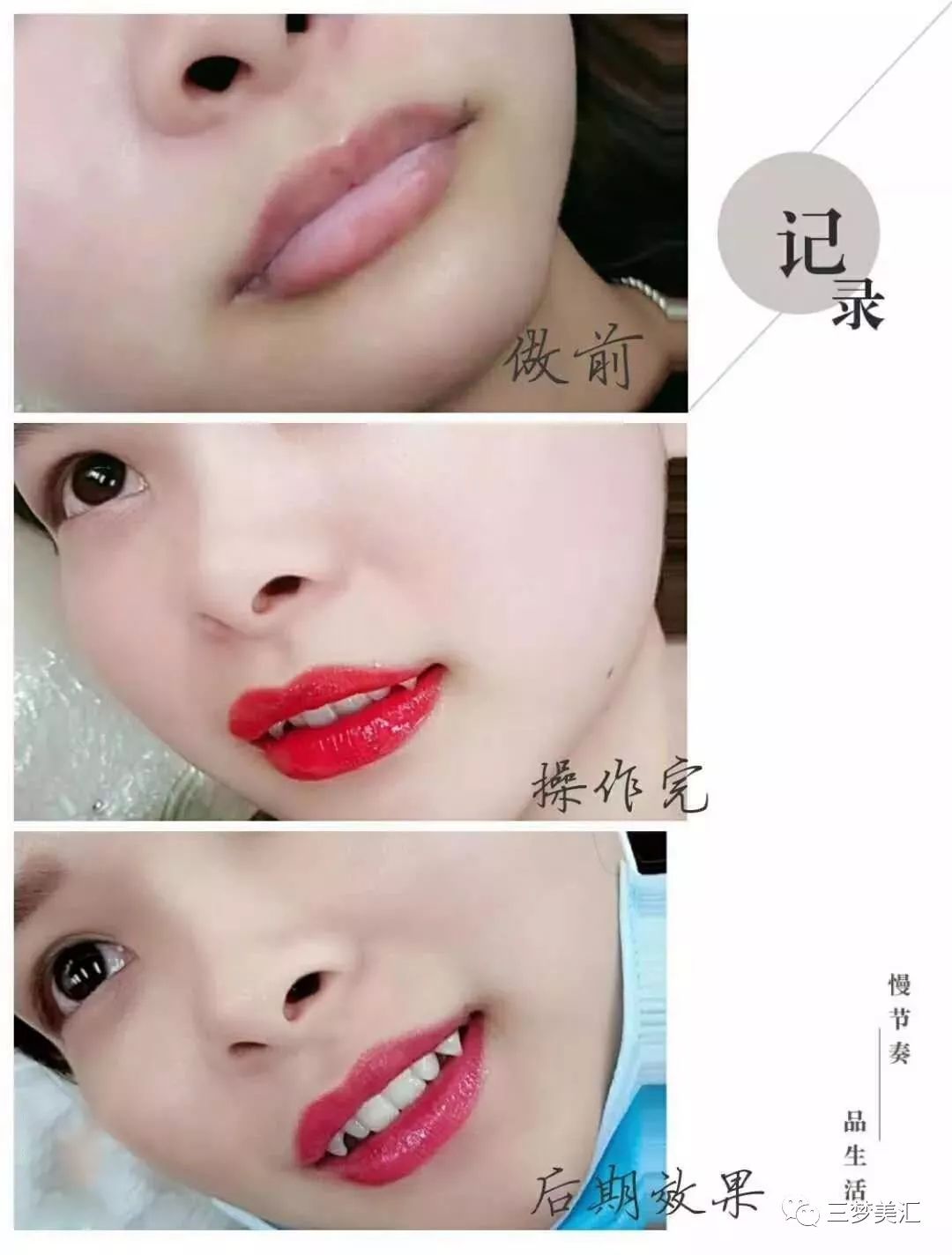 半永久定妆唇易上色,不肿胀小技巧!
