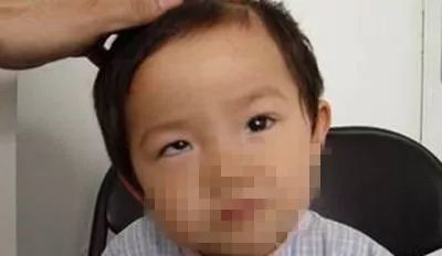                     揉眼睛、总歪头……宝宝这些小动作暗藏疾病信号，别不当回事