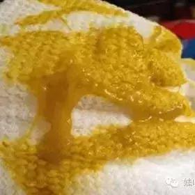                     怀疑孩子拉肚子了怎么办？
