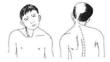                     揉眼睛、总歪头……宝宝这些小动作暗藏疾病信号，别不当回事