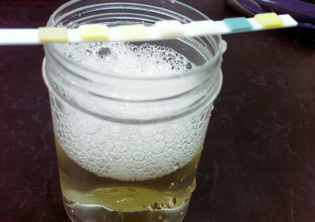 糖尿病肾病患者为何要低蛋白饮食?