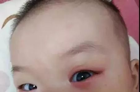                     揉眼睛、总歪头……宝宝这些小动作暗藏疾病信号，别不当回事
