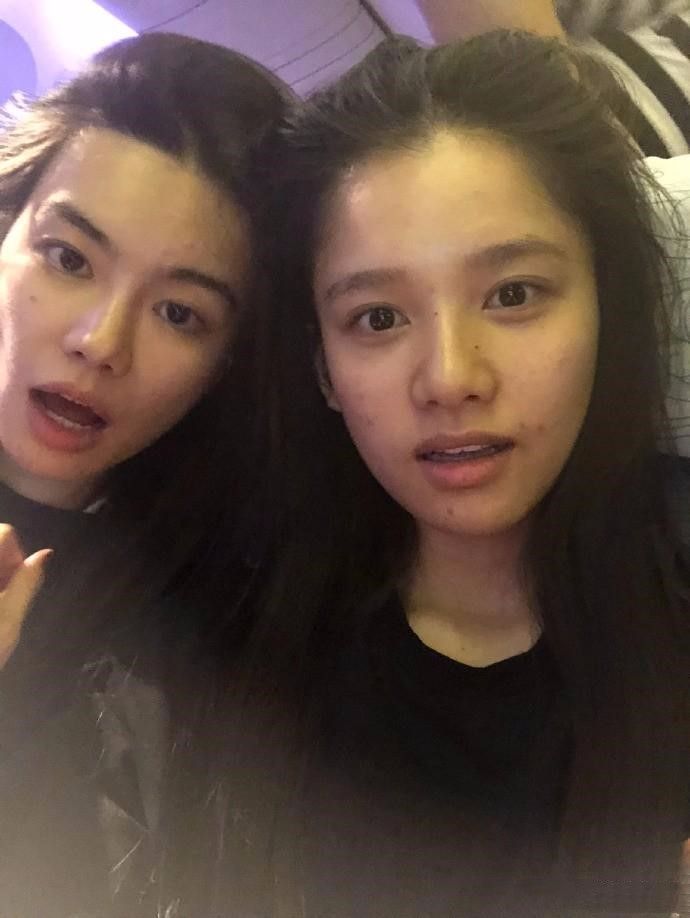 陈坤新签的小花张婧仪晒素颜脸上痘痘粒粒可见太真实了