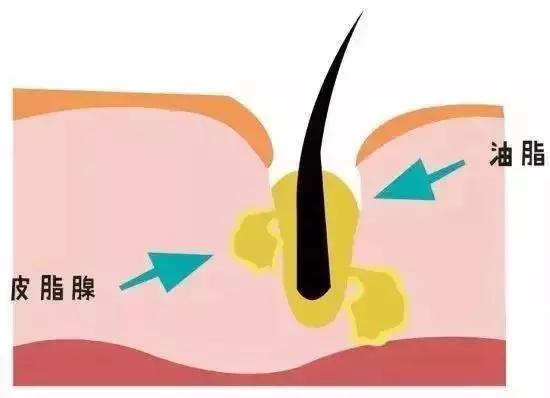 想要跟毛孔说byebye这些知识你都要知道