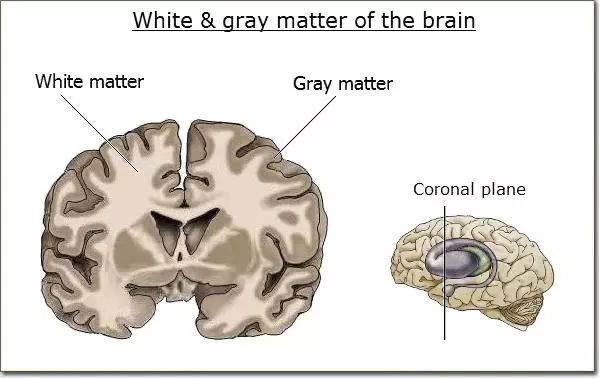 其大脑的白质与一般人没两样,但是其大脑的灰质(灰质负责白质之间的