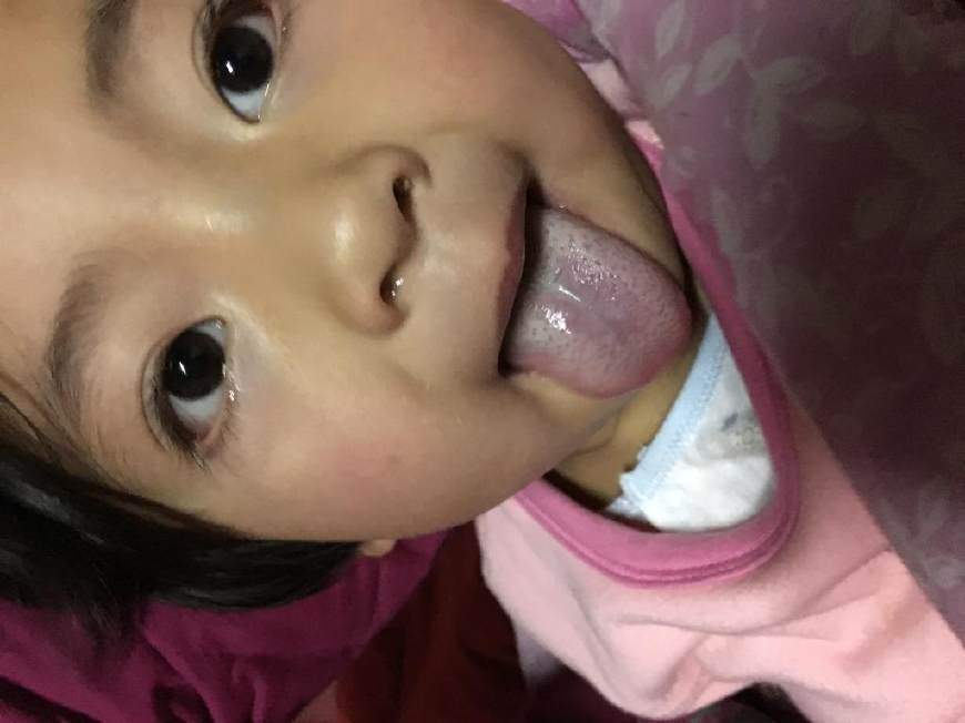                     孩子积食反复，造成脾胃虚弱，早发现早调理，看这个部位足够 !