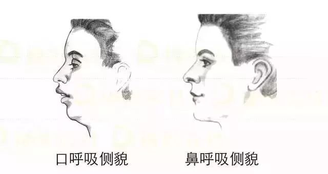                     孩子越长越“丑”？可能是这个原因！