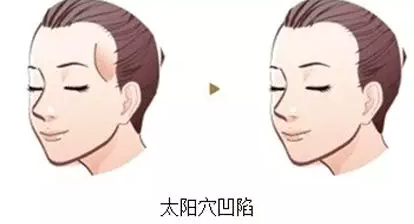 3e24640cbaee45c385ffe39be1a4af0d.png