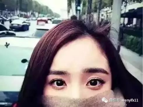 为什么会有高低眉 7d9bd844ecf14a39b1f7652ef1282ef3.jpeg