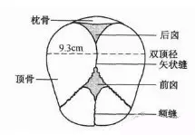 双顶径偏大，不能顺产么？