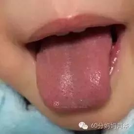                     宝宝一“热”就生病，但清热也要先对症！