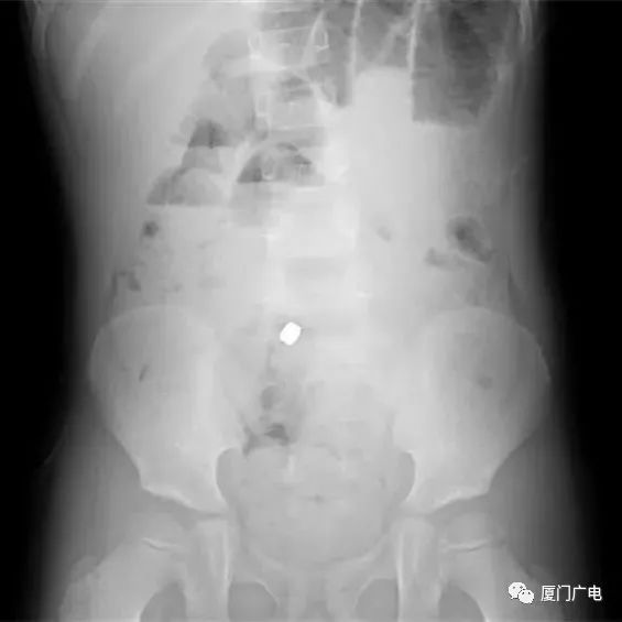 男生肚子痛是什么原因 ae6f07492f8c4ec7966f055ea226d9bd.jpeg