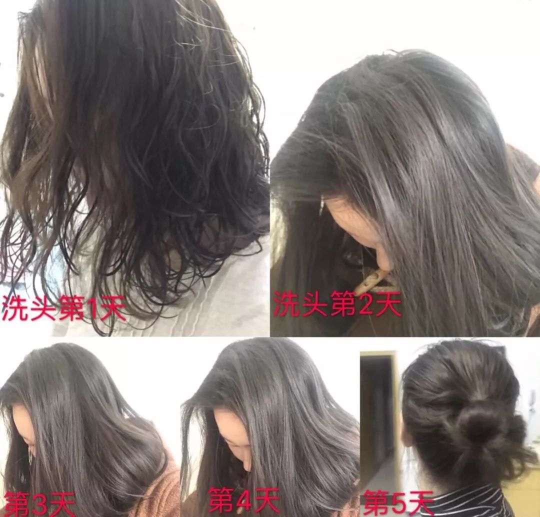 怎么缓解头皮瘙痒 d860411a2a324673b65b555d9744e2d1.jpeg