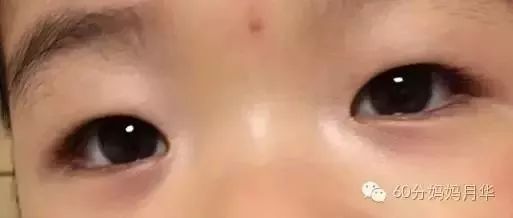                     宝宝一“热”就生病，但清热也要先对症！