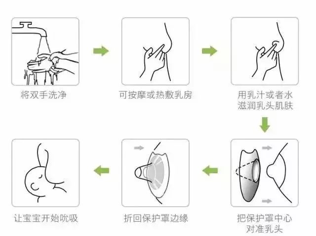 扁平凹陷乳头还能好好哺乳吗