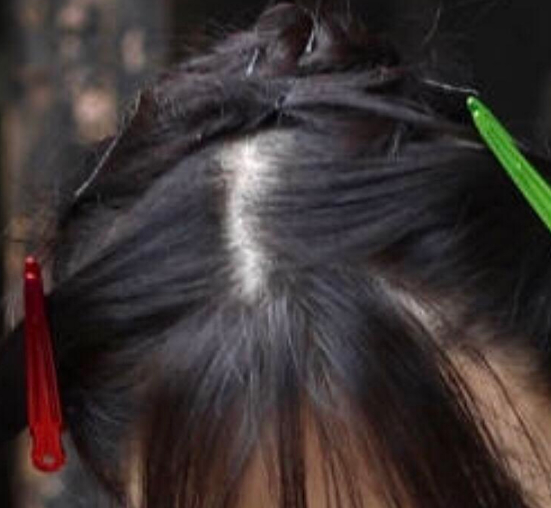 减肥怎么减不掉头发 1a70f0abf3fe4bdabb86931d81a4b631.png