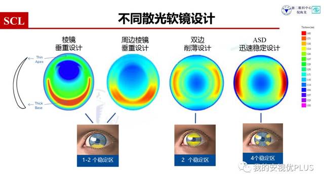 从75度到300度之间的散光可以适用的; 对视觉质量要求高,配戴最佳球