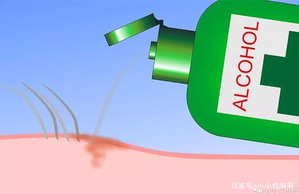                     1月之内3人身亡，宝宝身上出现这种“小黑痣”别大意！